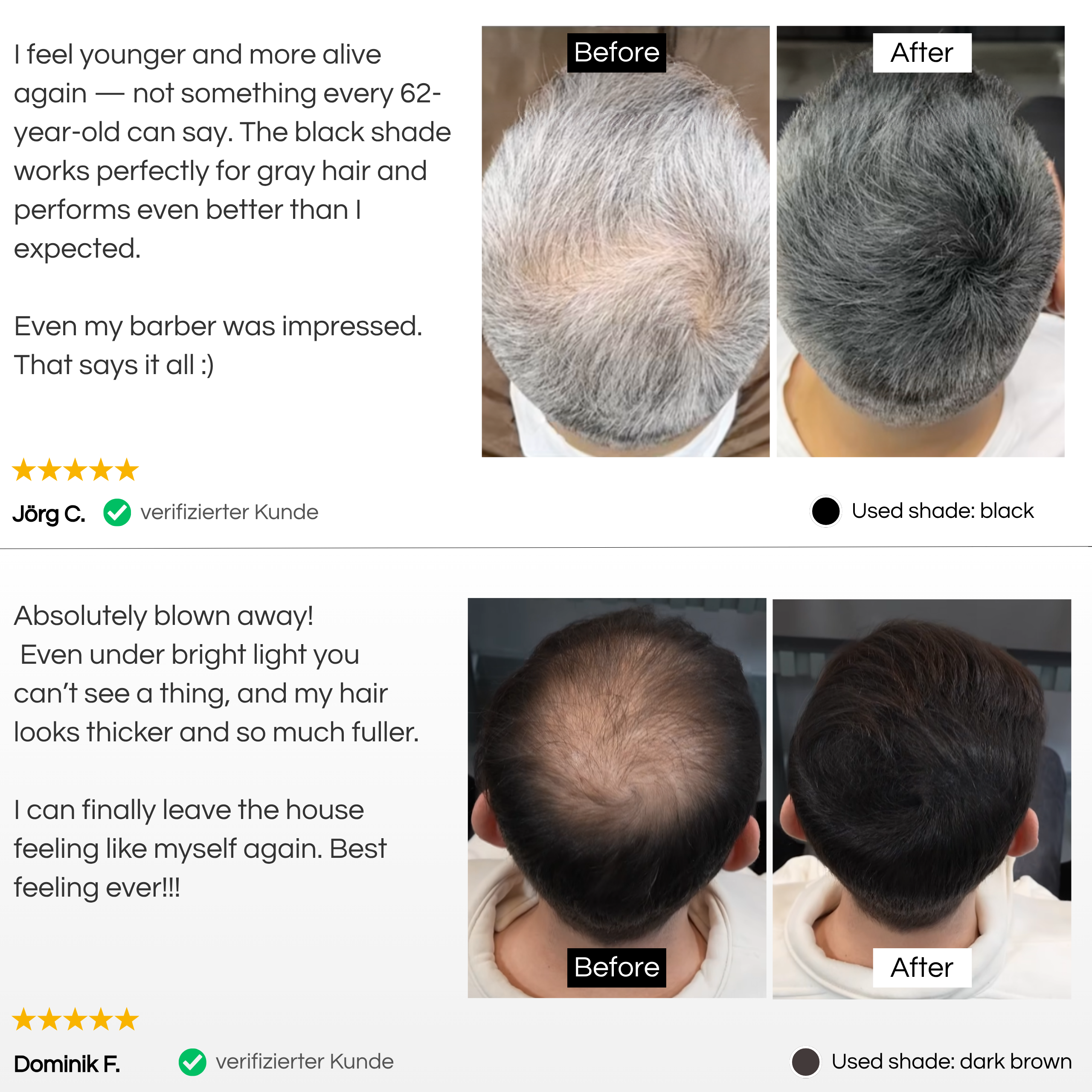 TrueShade® - Covers hair loss for 7 days. Natural and invisible.