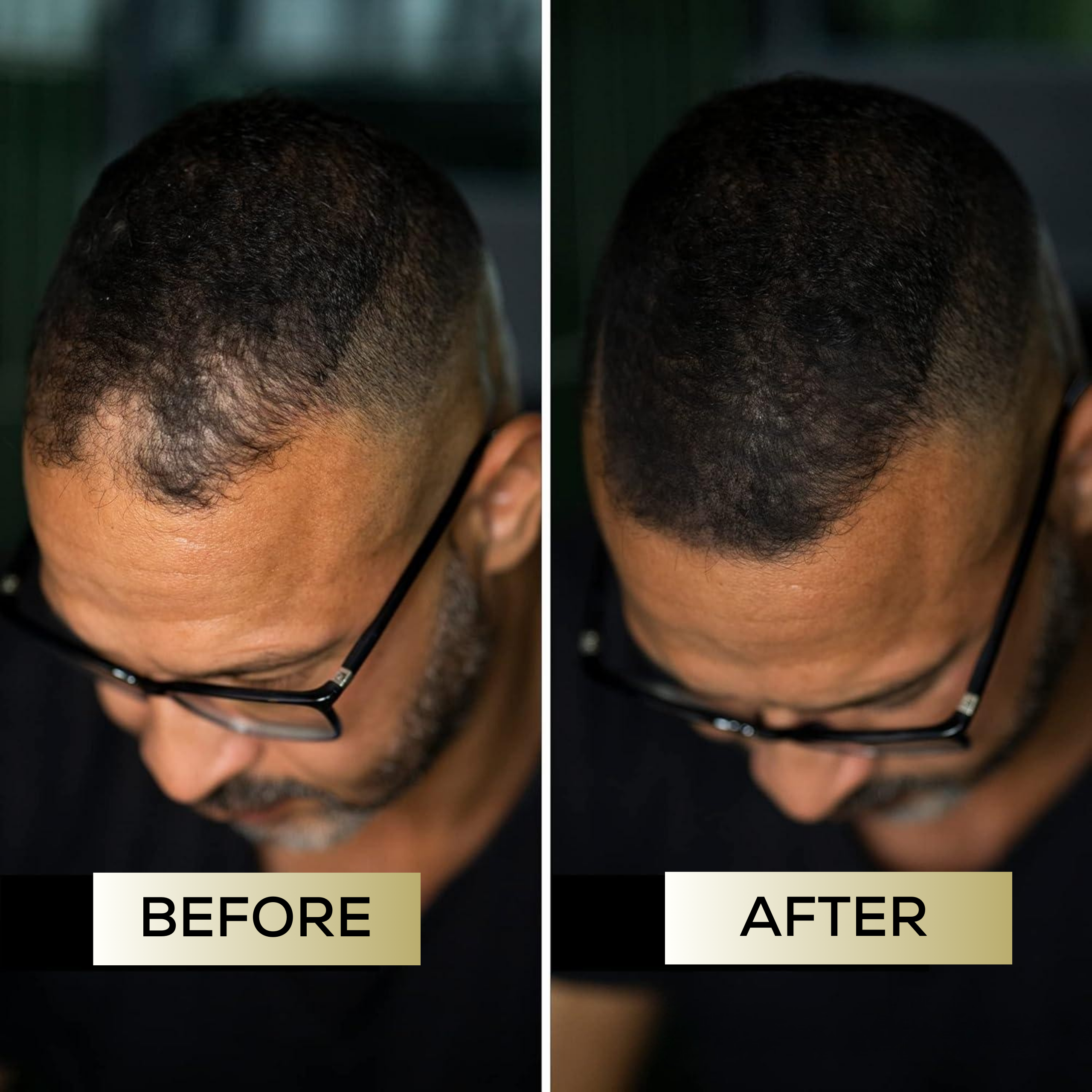 MagicColour™ – For naturally fuller & confident-looking hair