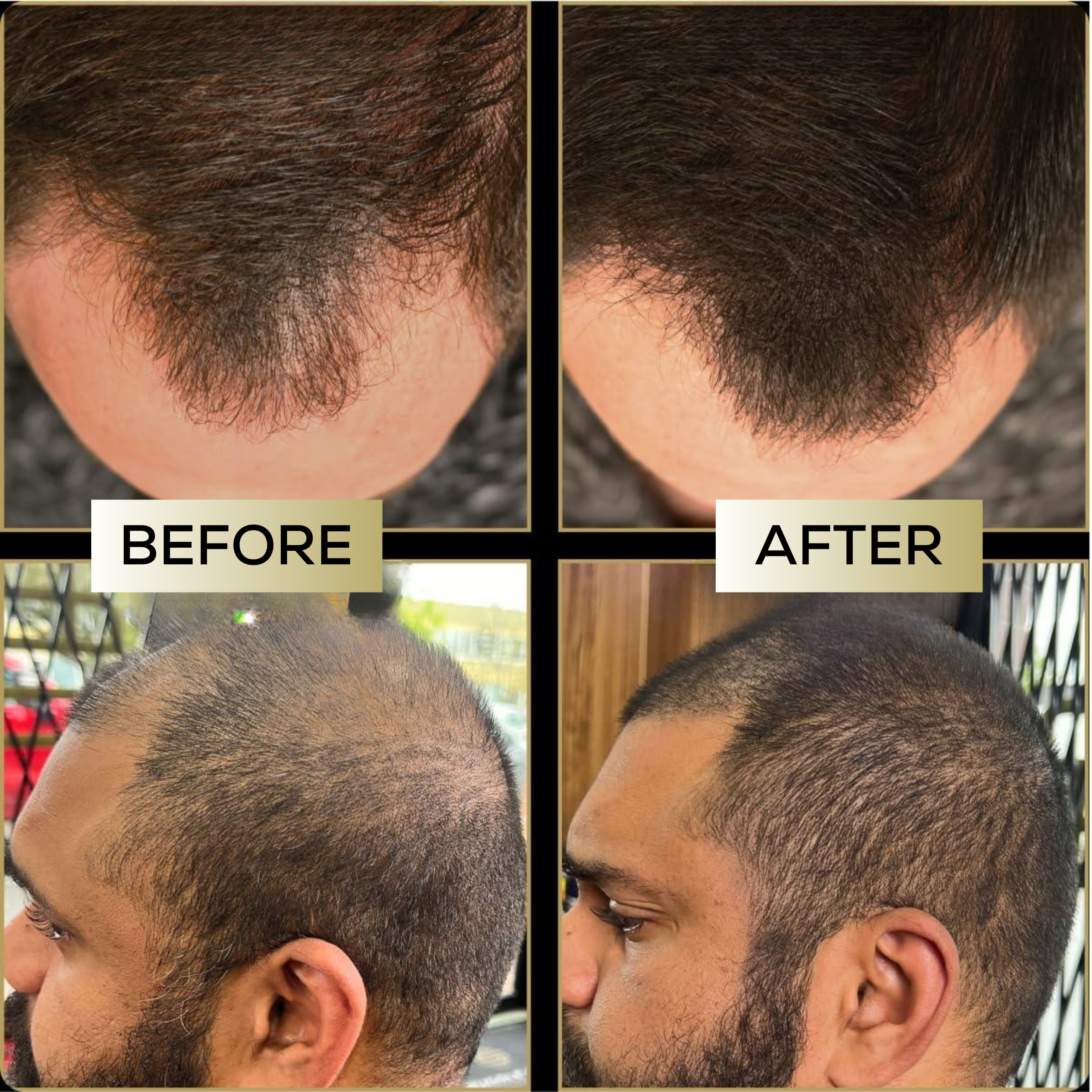 MagicColour™ – For naturally fuller & confident-looking hair