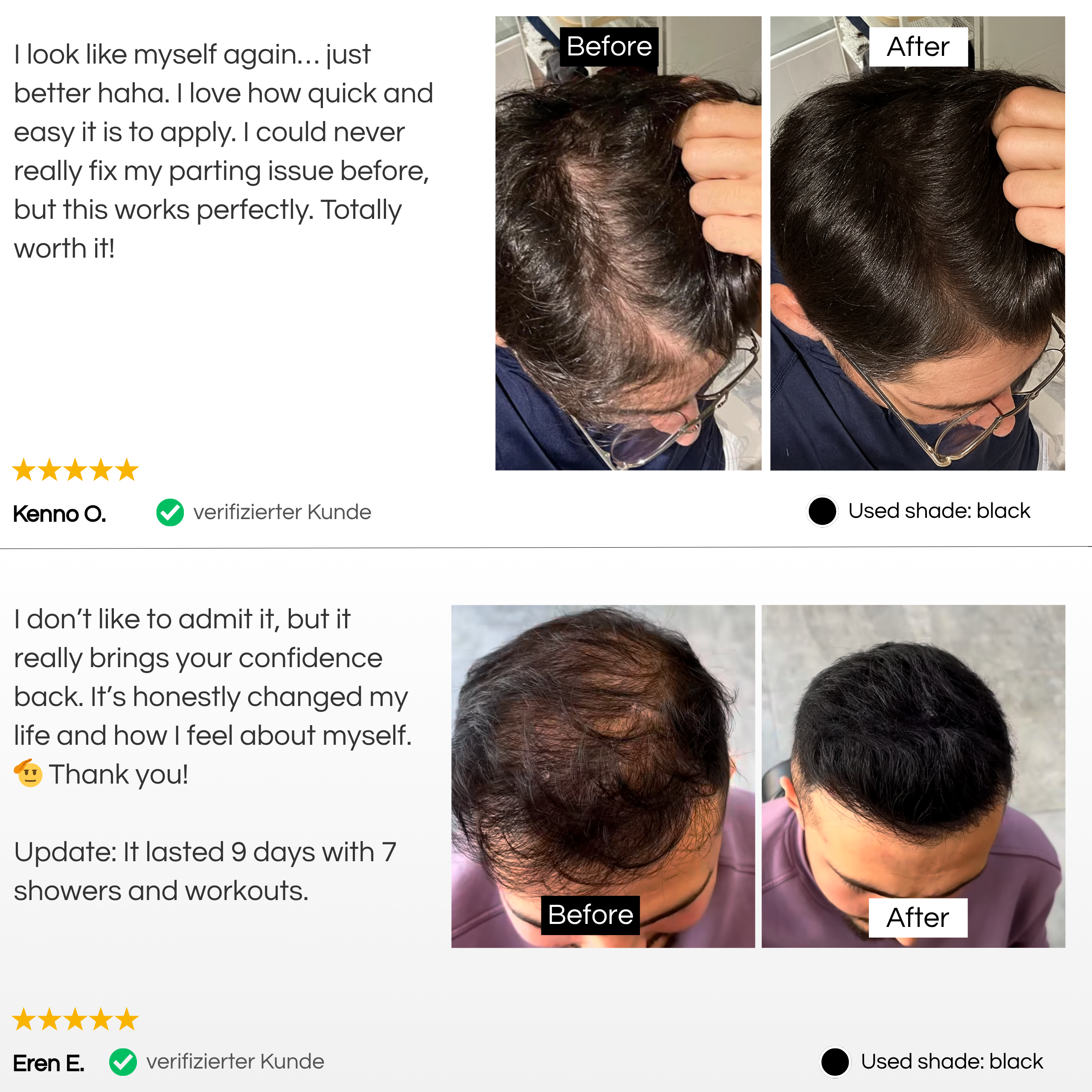 TrueShade® - Covers hair loss for 7 days. Natural and invisible.