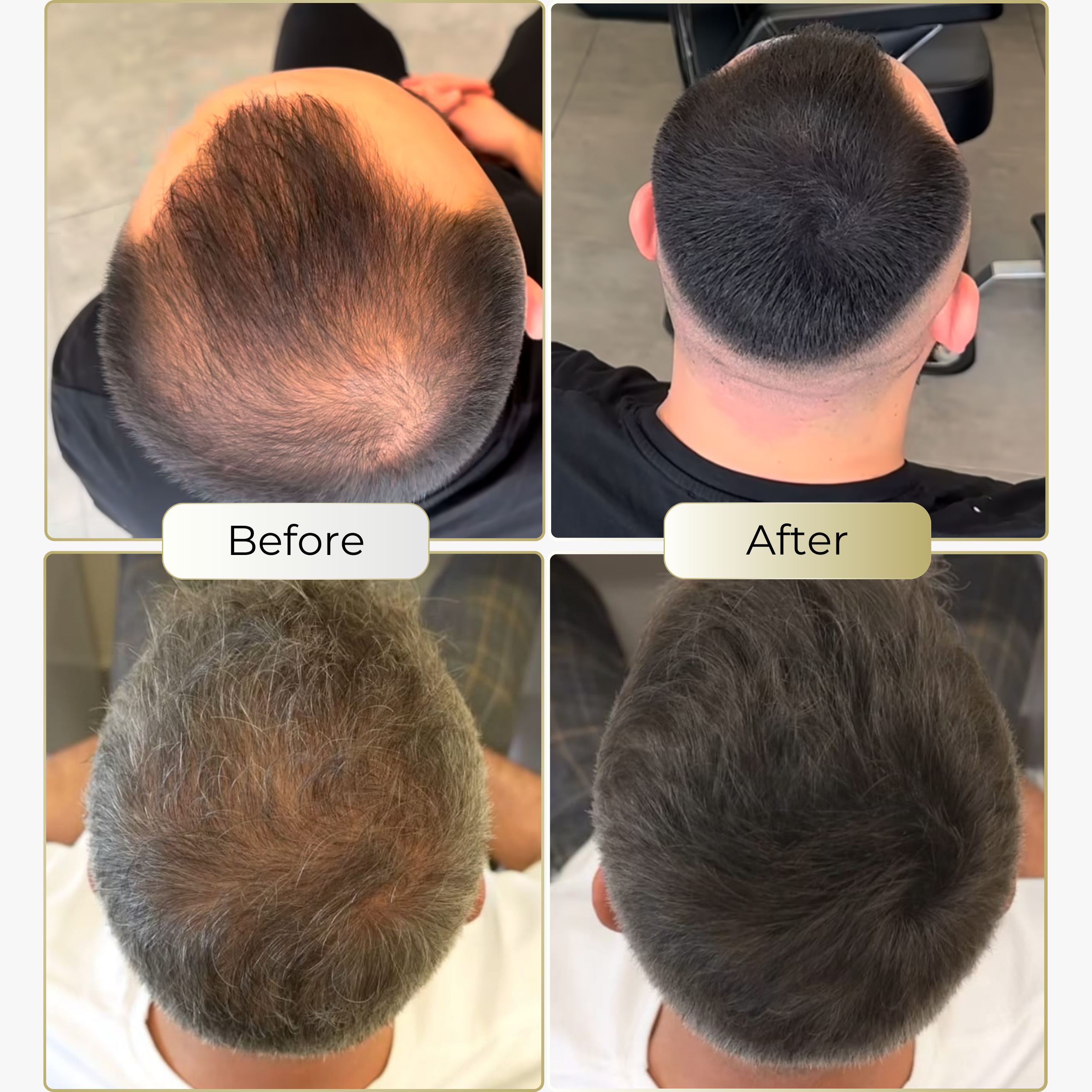 TrueShade™ –  for naturally fuller looking hair - lasts for 7 days straight
