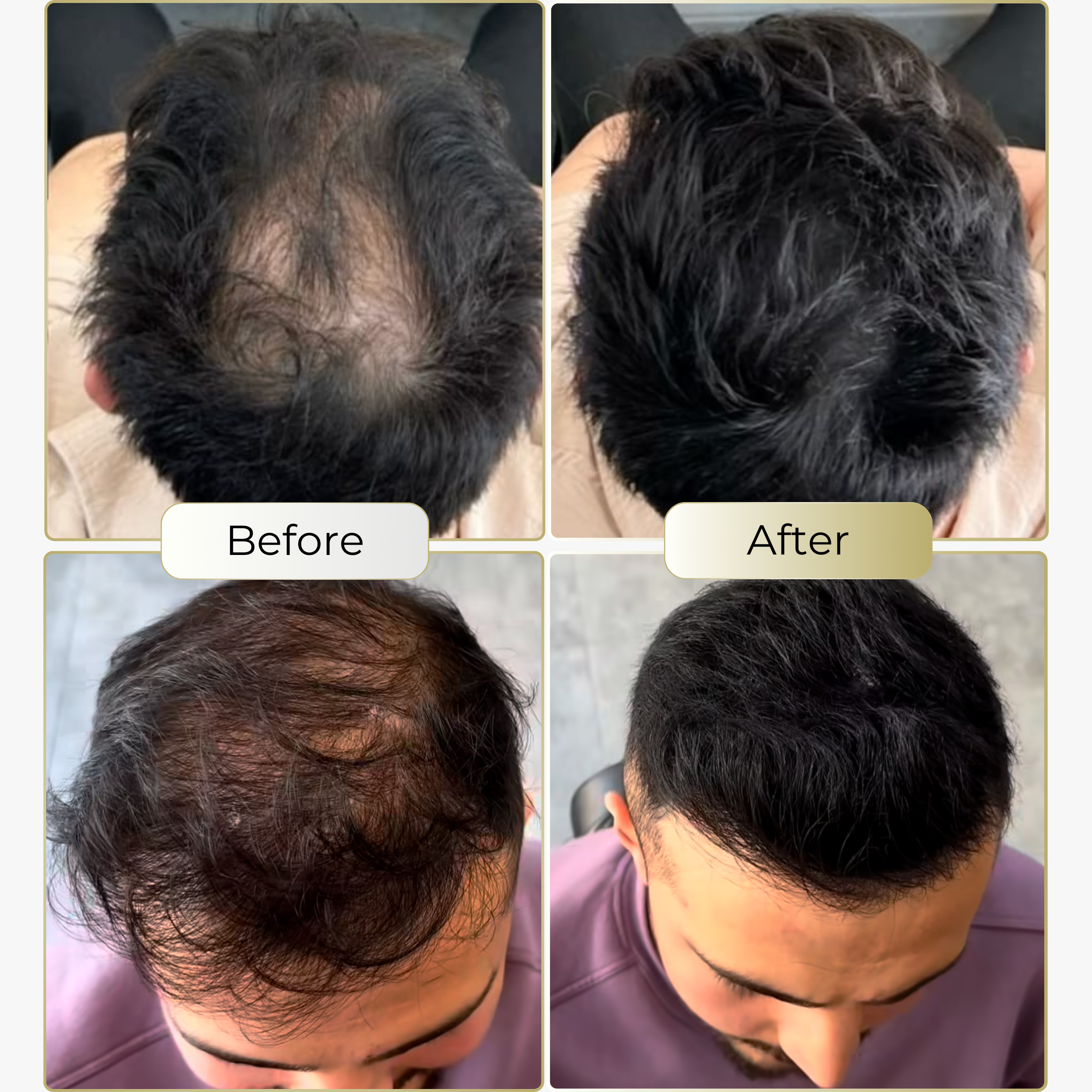 TrueShade™ –  for naturally fuller looking hair - lasts for 7 days straight